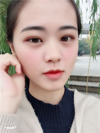双眼皮手术
