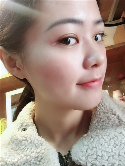 双眼皮手术