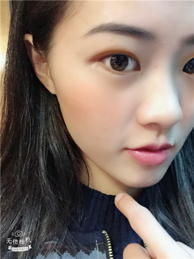 双眼皮手术