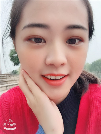 双眼皮手术