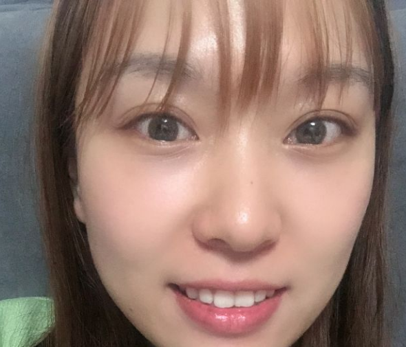 去眼袋手术