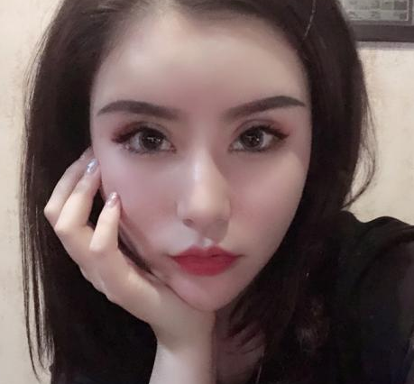 去眼袋手术