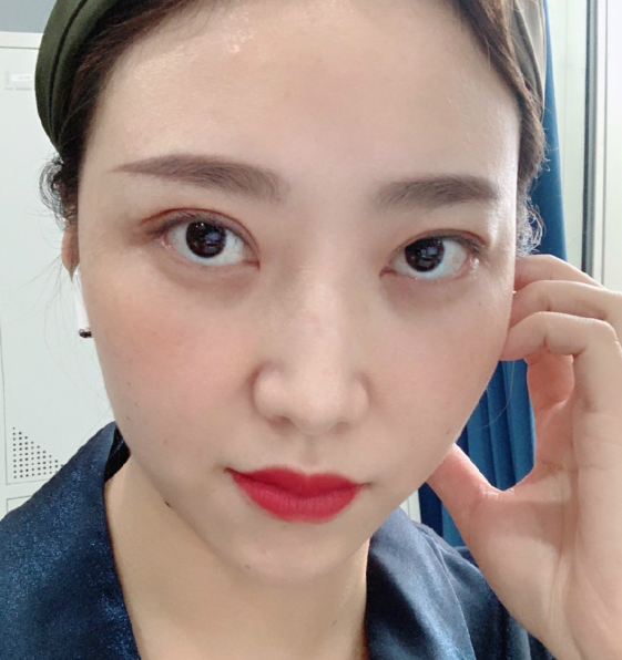 去眼袋手术