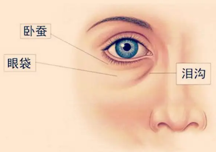 去眼袋手术