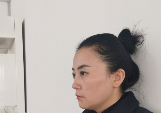 去眼袋手术