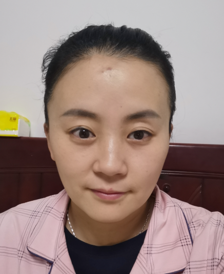 去眼袋手术