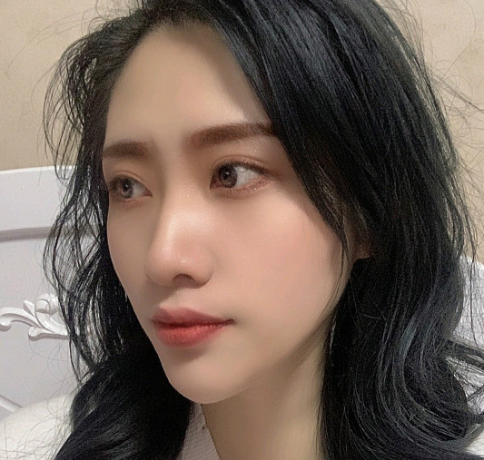 去眼袋手术