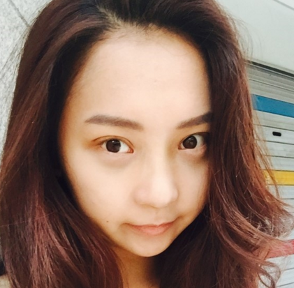 去眼袋手术