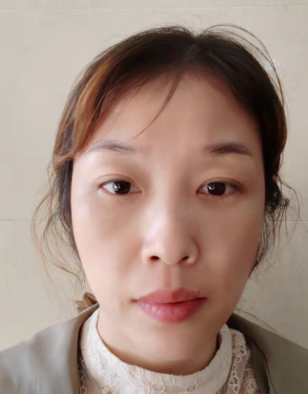 去眼袋手术