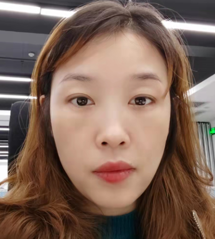 去眼袋手术