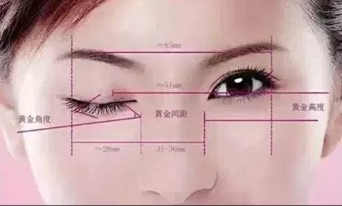 双眼皮手术