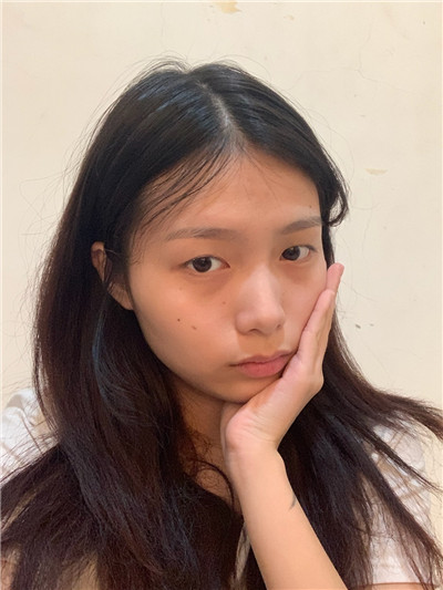 双眼皮手术