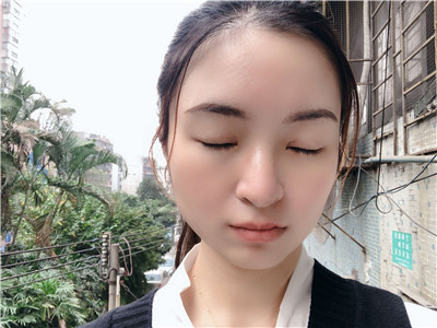 做超声波复合双眼皮7天真实分享，效果好...854