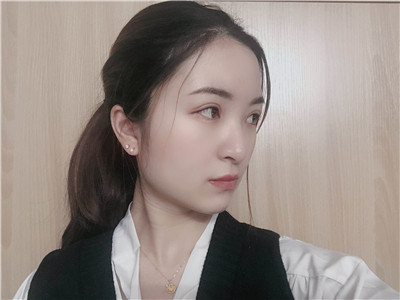 做超声波复合双眼皮7天真实分享，效果好...854