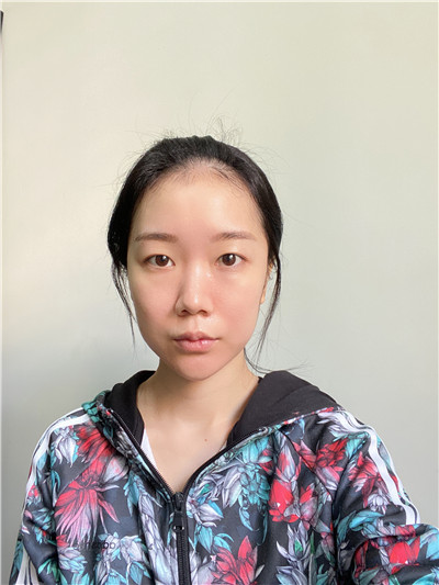 双眼皮手术