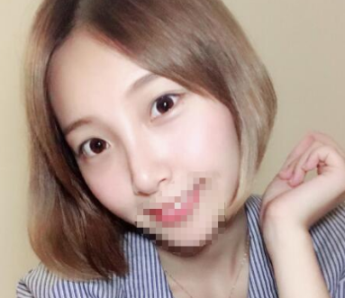 去眼袋手术