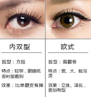 双眼皮手术