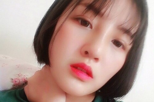 双眼皮手术