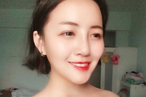 双眼皮手术
