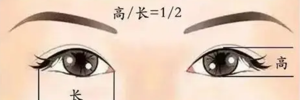 双眼皮手术