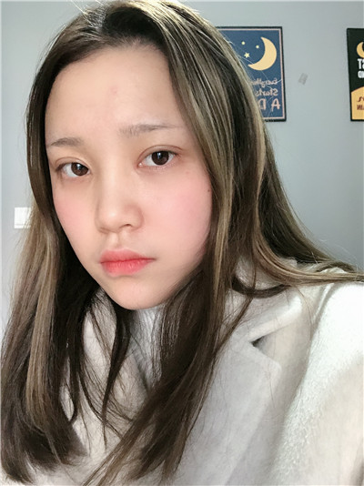 双眼皮手术