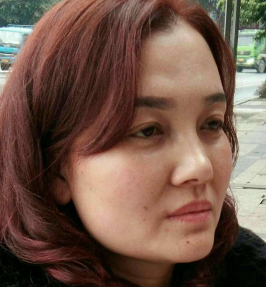 去眼袋手术