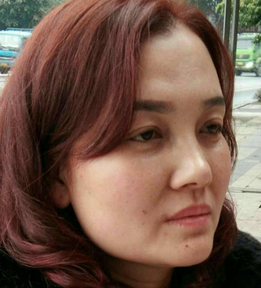 去眼袋手术