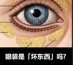去眼袋手术
