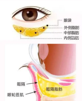 去眼袋手术
