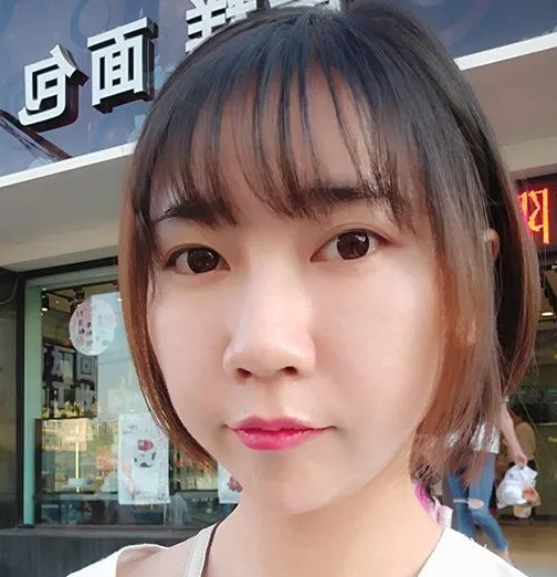 去眼袋手术