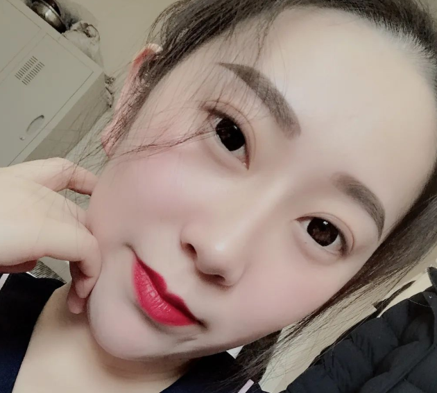 双眼皮手术