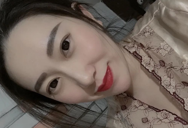 双眼皮手术