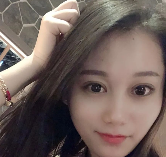 双眼皮手术
