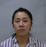 去眼袋手术