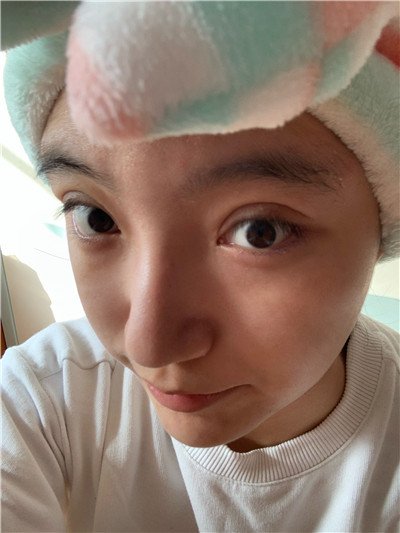 双眼皮手术