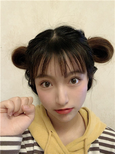 双眼皮手术