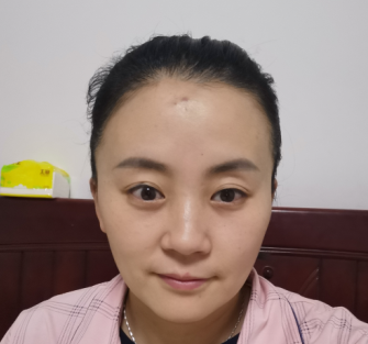 去眼袋手术
