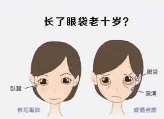 去眼袋手术