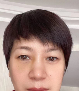 去眼袋手术