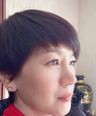 去眼袋手术