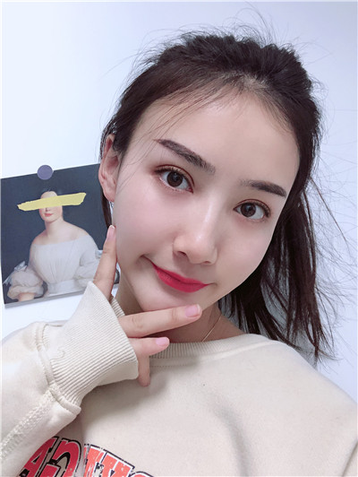 双眼皮手术