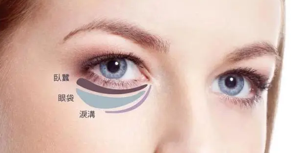 去眼袋手术
