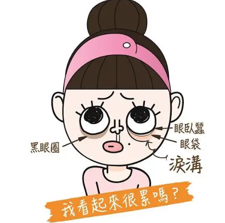 去眼袋手术