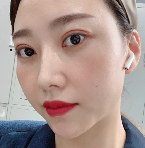 去眼袋手术