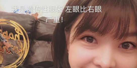去眼袋手术