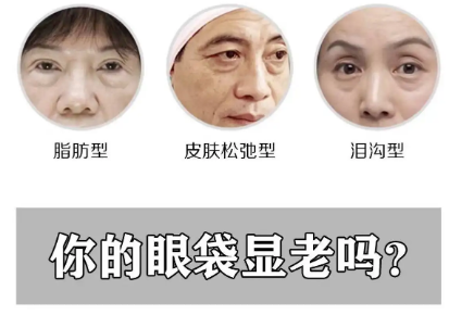 去眼袋手术