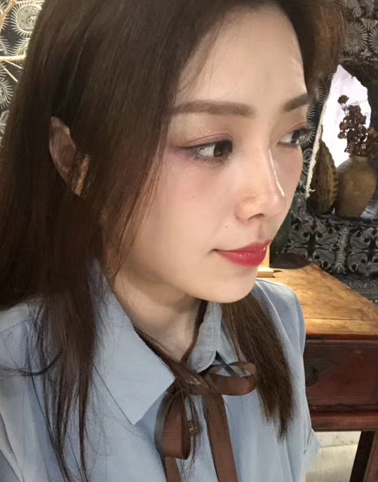 去眼袋手术