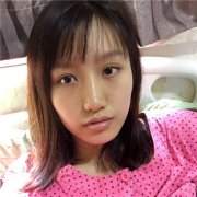 自体脂肪胶填充可以改变面部轮廓？