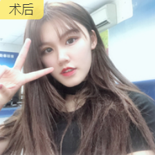 去眼袋手术