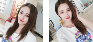 去眼袋手术
